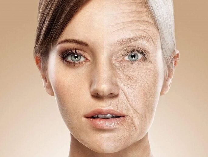 ansigtshud før og efter laserforyngelse